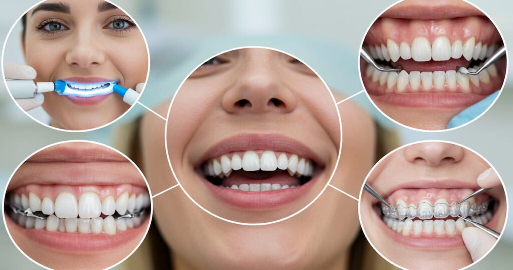 Cosmestic Dentistry
