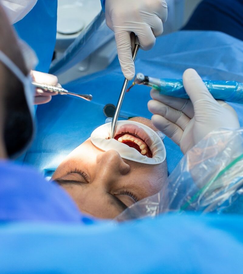 dentist-assistant-with-tool-makes-some-manipulations-patient-s-mouth (1)