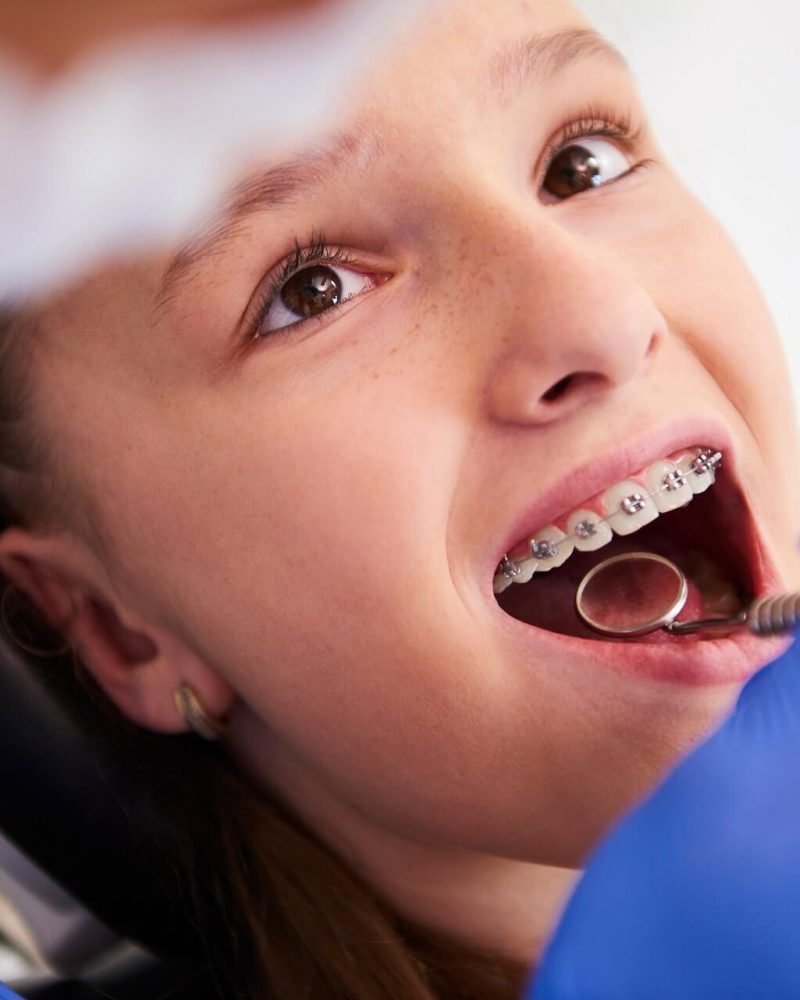 girl-with-braces-during-routine-dental-examination (1)