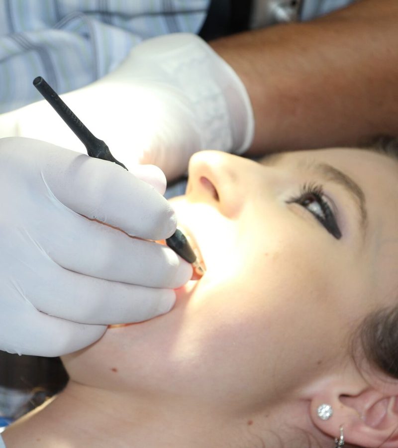 teeth-cleaning-g8a78d1e6f_1920 (1)